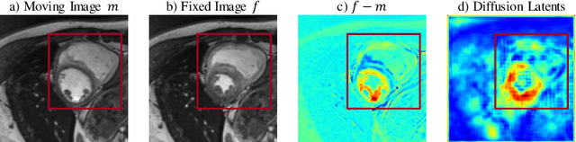 Figure 1 for FSDiffReg: Feature-wise and Score-wise Diffusion-guided Unsupervised Deformable Image Registration for Cardiac Images