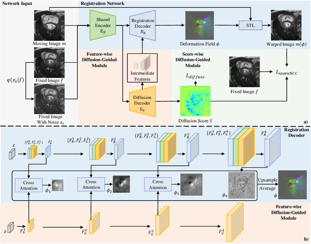 Figure 3 for FSDiffReg: Feature-wise and Score-wise Diffusion-guided Unsupervised Deformable Image Registration for Cardiac Images