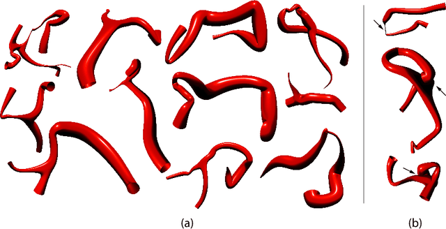 Figure 3 for VesselVAE: Recursive Variational Autoencoders for 3D Blood Vessel Synthesis