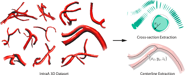 Figure 4 for VesselVAE: Recursive Variational Autoencoders for 3D Blood Vessel Synthesis