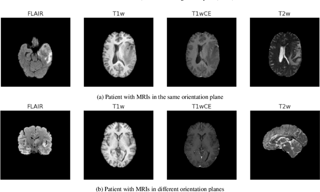 Figure 3 for MGMT promoter methylation status prediction using MRI scans? An extensive experimental evaluation of deep learning models