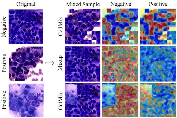 Figure 1 for CellMix: A General Instance Relationship based Method for Data Augmentation Towards Pathology Image Analysis