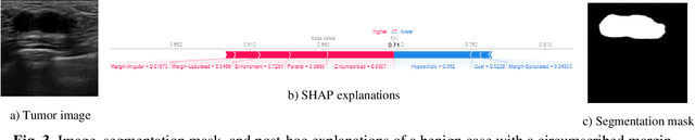 Figure 3 for Post-Hoc Explainability of BI-RADS Descriptors in a Multi-task Framework for Breast Cancer Detection and Segmentation