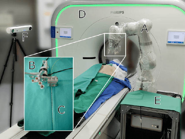 Figure 4 for Collaborative Robotic Biopsy with Trajectory Guidance and Needle Tip Force Feedback