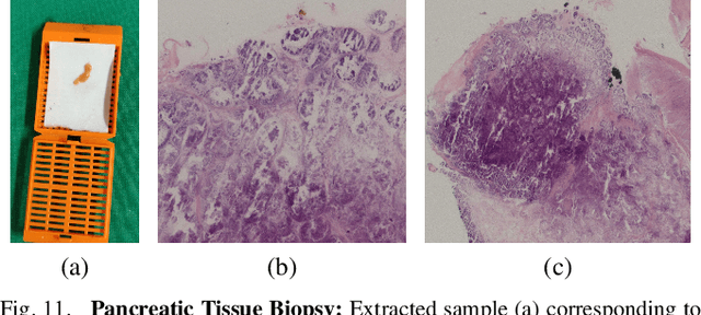 Figure 3 for Collaborative Robotic Biopsy with Trajectory Guidance and Needle Tip Force Feedback