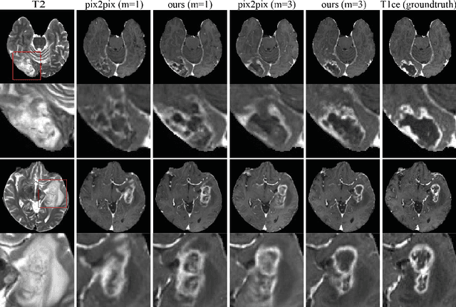 Figure 4 for Local implicit neural representations for multi-sequence MRI translation