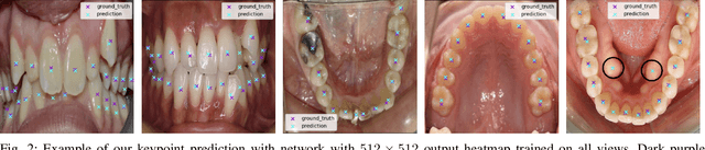 Figure 2 for Processing and Segmentation of Human Teeth from 2D Images using Weakly Supervised Learning