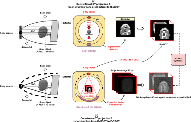 Figure 2 for Enhanced artificial intelligence-based diagnosis using CBCT with internal denoising: Clinical validation for discrimination of fungal ball, sinusitis, and normal cases in the maxillary sinus