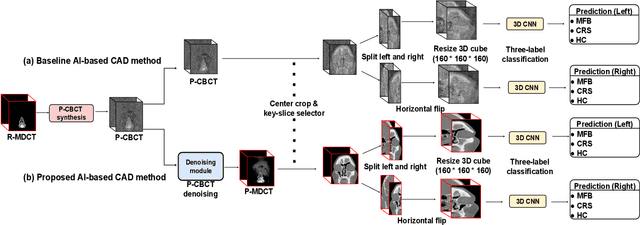 Figure 3 for Enhanced artificial intelligence-based diagnosis using CBCT with internal denoising: Clinical validation for discrimination of fungal ball, sinusitis, and normal cases in the maxillary sinus