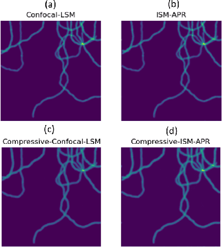 Figure 4 for Compressive Image Scanning Microscope