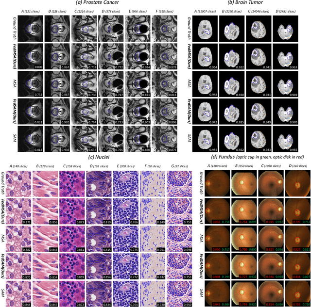 Figure 3 for FedFMS: Exploring Federated Foundation Models for Medical Image Segmentation