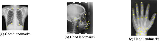 Figure 1 for Is in-domain data beneficial in transfer learning for landmarks detection in x-ray images?