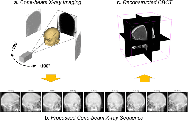 Figure 3 for Robust Single-view Cone-beam X-ray Pose Estimation with Neural Tuned Tomography (NeTT) and Masked Neural Radiance Fields (mNeRF)