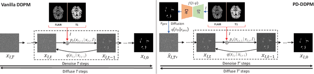 Figure 1 for Accelerating Diffusion Models via Pre-segmentation Diffusion Sampling for Medical Image Segmentation