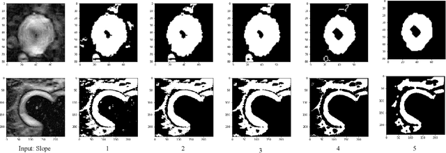 Figure 2 for Automatic Crater Shape Retrieval using Unsupervised and Semi-Supervised Systems