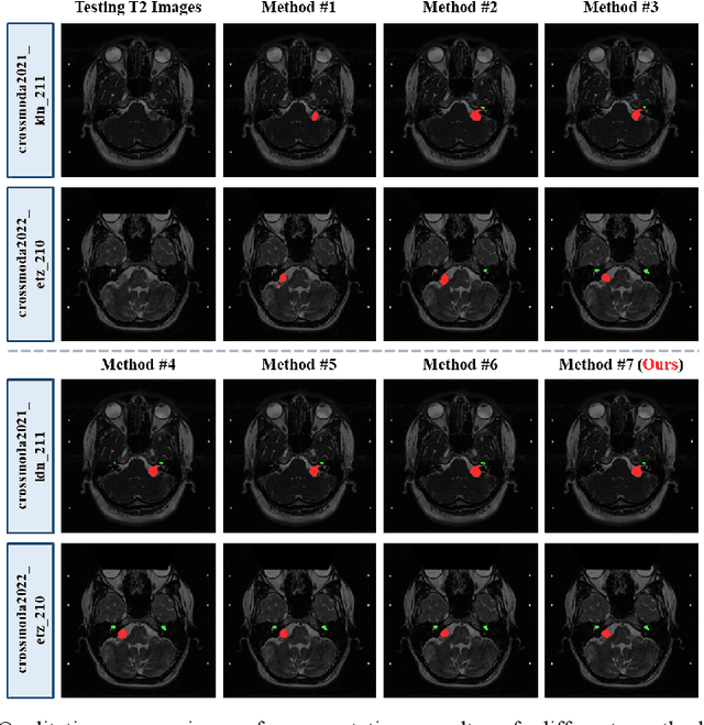 Figure 4 for An Unpaired Cross-modality Segmentation Framework Using Data Augmentation and Hybrid Convolutional Networks for Segmenting Vestibular Schwannoma and Cochlea