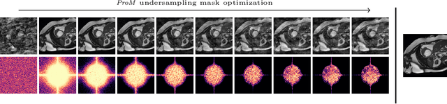 Figure 1 for Constrained Probabilistic Mask Learning for Task-specific Undersampled MRI Reconstruction