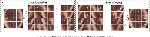 Figure 3 for H-vmunet: High-order Vision Mamba UNet for Medical Image Segmentation