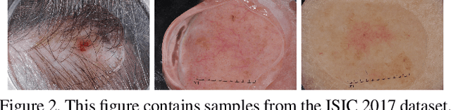 Figure 3 for Enhancing Medical Image Segmentation: Optimizing Cross-Entropy Weights and Post-Processing with Autoencoders