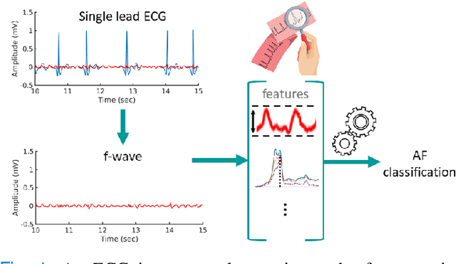 Figure 1 for Machine Learning for Ranking f-wave Extraction Methods in Single-Lead ECGs