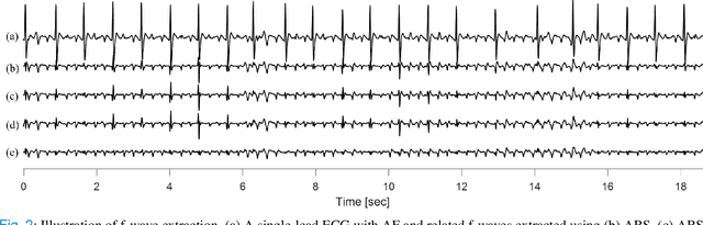Figure 2 for Machine Learning for Ranking f-wave Extraction Methods in Single-Lead ECGs