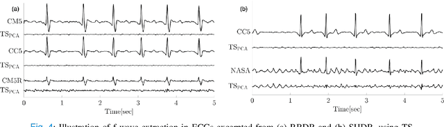 Figure 4 for Machine Learning for Ranking f-wave Extraction Methods in Single-Lead ECGs