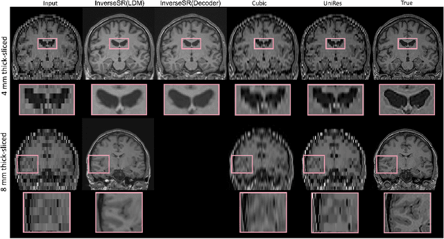 Figure 3 for InverseSR: 3D Brain MRI Super-Resolution Using a Latent Diffusion Model