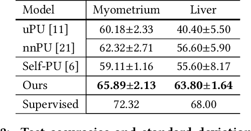 Figure 4 for Split-PU: Hardness-aware Training Strategy for Positive-Unlabeled Learning