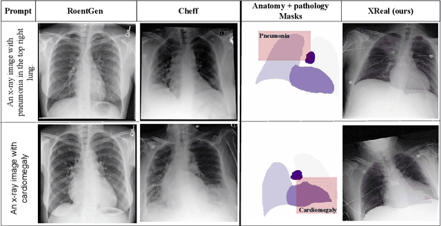Figure 1 for XReal: Realistic Anatomy and Pathology-Aware X-ray Generation via Controllable Diffusion Model