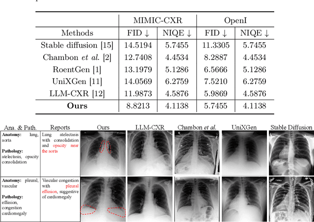 Figure 2 for Medical Image Synthesis via Fine-Grained Image-Text Alignment and Anatomy-Pathology Prompting