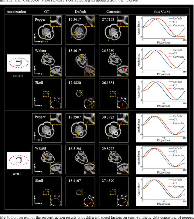 Figure 4 for INeAT: Iterative Neural Adaptive Tomography