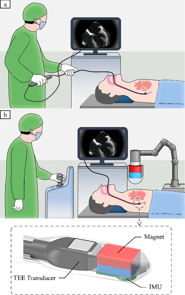 Figure 1 for Closed-Loop Magnetic Manipulation for Robotic Transesophageal Echocardiography