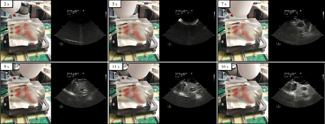 Figure 2 for Closed-Loop Magnetic Manipulation for Robotic Transesophageal Echocardiography