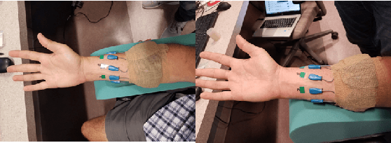 Figure 1 for User Training with Error Augmentation for Electromyogram-based Gesture Classification