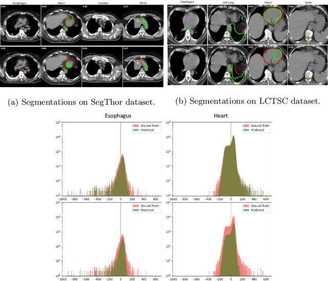 Figure 4 for Uncertainty Driven Bottleneck Attention U-net for OAR Segmentation