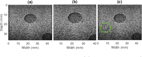 Figure 3 for Lateral Strain Imaging using Self-supervised and Physically Inspired Constraints in Unsupervised Regularized Elastography