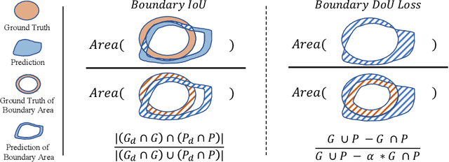 Figure 1 for Boundary Difference Over Union Loss For Medical Image Segmentation