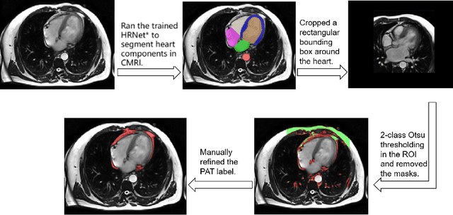Figure 1 for PAT-CNN: Automatic Segmentation and Quantification of Pericardial Adipose Tissue from T2-Weighted Cardiac Magnetic Resonance Images