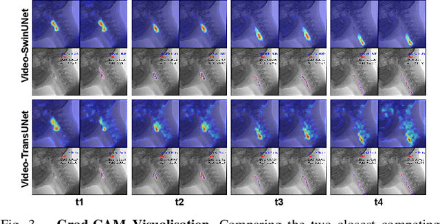 Figure 3 for Video-SwinUNet: Spatio-temporal Deep Learning Framework for VFSS Instance Segmentation