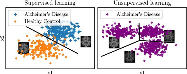 Figure 3 for Promises and pitfalls of deep neural networks in neuroimaging-based psychiatric research