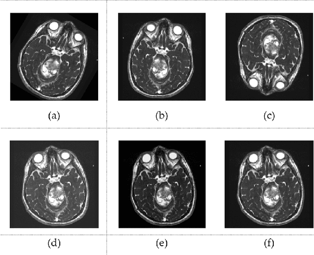 Figure 2 for Realism in Action: Anomaly-Aware Diagnosis of Brain Tumors from Medical Images Using YOLOv8 and DeiT