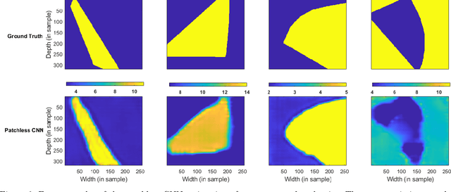 Figure 4 for A deep learning approach for patchless estimation of ultrasound quantitative parametric image with uncertainty measurement
