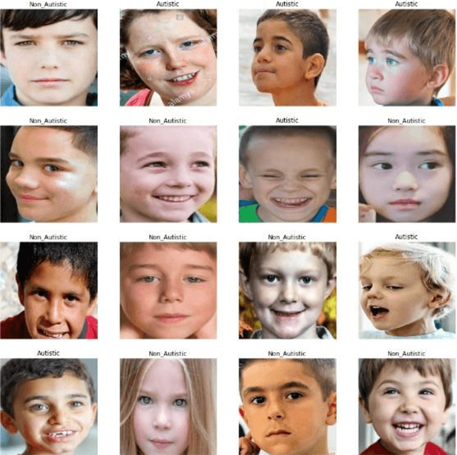 Figure 2 for Autism Disease Detection Using Transfer Learning Techniques: Performance Comparison Between Central Processing Unit vs Graphics Processing Unit Functions for Neural Networks