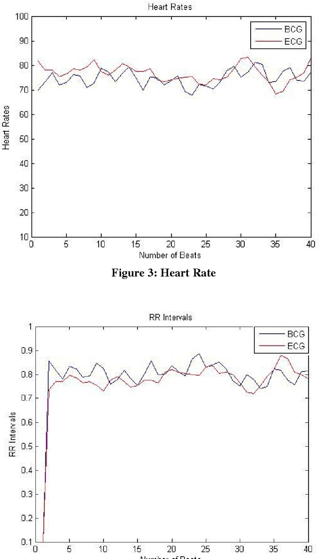 Figure 2 for Comparison of HRV Indices of ECG and BCG Signals