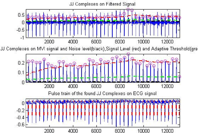 Figure 4 for Comparison of HRV Indices of ECG and BCG Signals