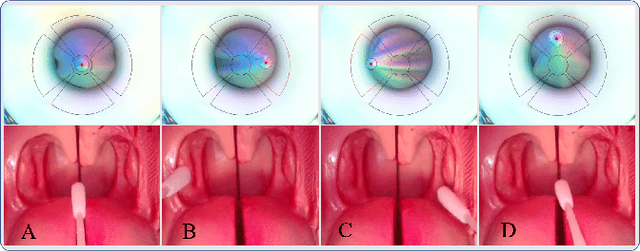 Figure 2 for Visuotactile Sensor Enabled Pneumatic Device Towards Compliant Oropharyngeal Swab Sampling
