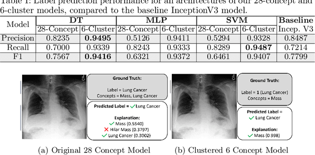 Figure 2 for Transparent and Clinically Interpretable AI for Lung Cancer Detection in Chest X-Rays