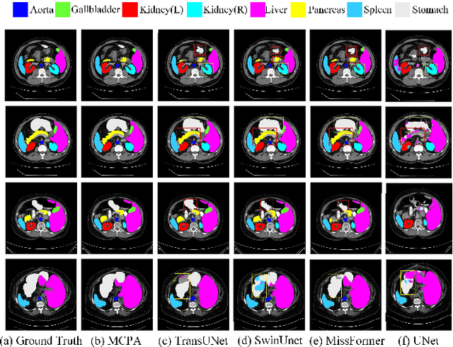 Figure 4 for MCPA: Multi-scale Cross Perceptron Attention Network for 2D Medical Image Segmentation