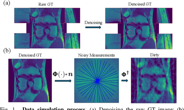 Figure 1 for Scalable Non-Cartesian Magnetic Resonance Imaging with R2D2