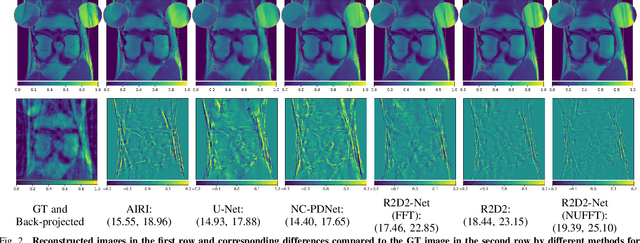 Figure 2 for Scalable Non-Cartesian Magnetic Resonance Imaging with R2D2